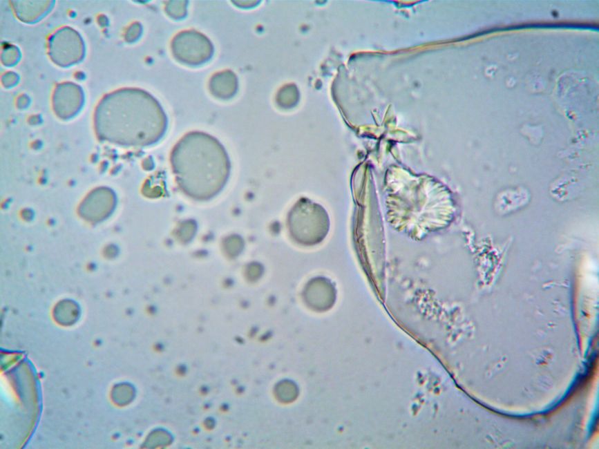 Detailed magnified image illustrating the cellular structure under a microscope.