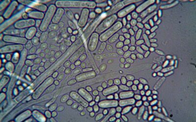 Foldscope 140x Magnification Cell Examples: What Can You Actually See in June 2026?