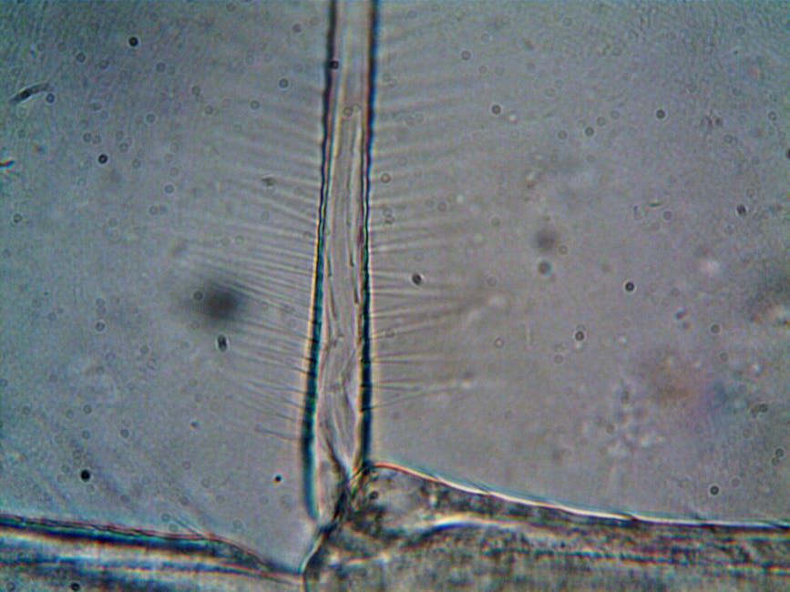 High magnification image revealing intricate details of microorganisms under a microscope.